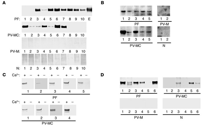 IP-IB analysis of recombinant Dsg4 proteins in pemphigus and normal sera...