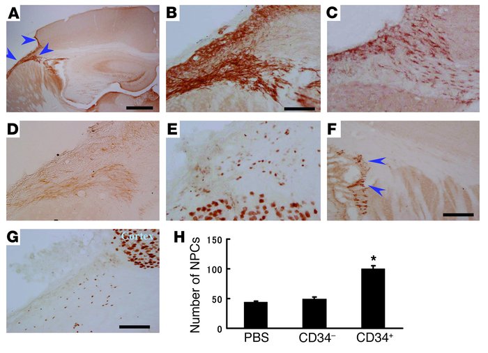 CD34+ cell transplantation accelerates neuronal regeneration after strok...