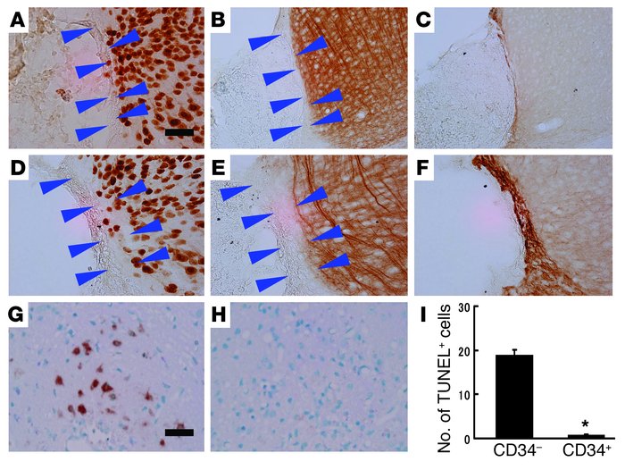 Therapeutic neovascularization, due to CD34+ cell transplantation after ...
