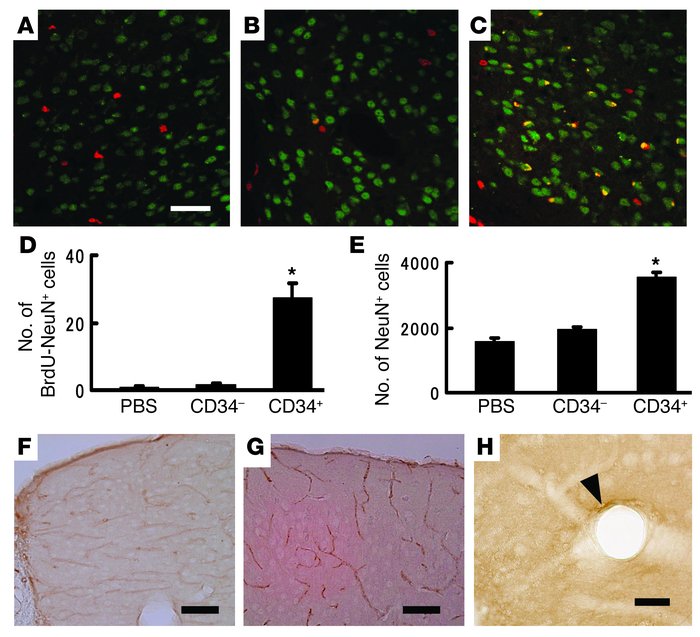 Therapeutic neovascularization supports survival of regenerating neurons...