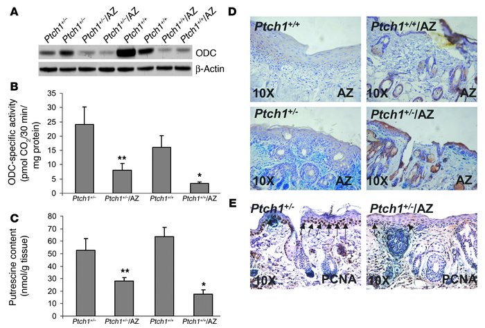 Effects of AZ overexpression on the levels and activity of ODC in the sk...