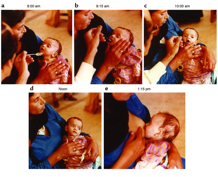 A three-month-old Egyptian boy in a rehydration treatment and training c...