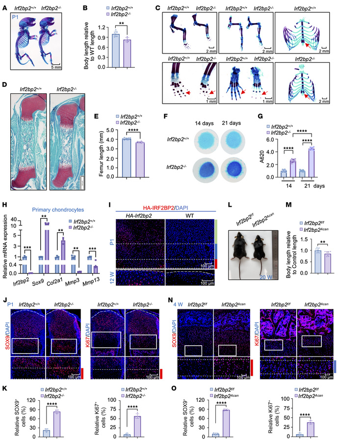 
Irf2bp2 deficiency leads to abnormal bone development and promotes SOX9...