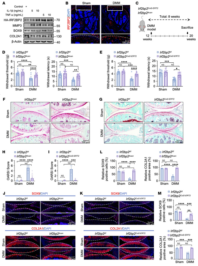 Cartilage-specific deletion of Irf2bp2 attenuates OA progression and ass...