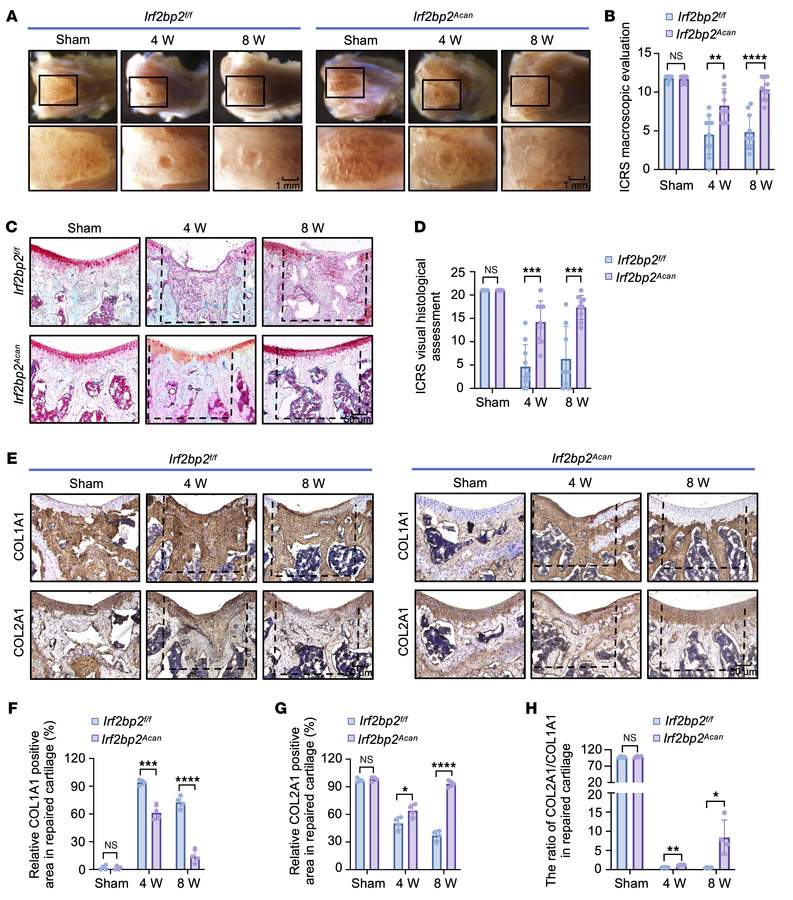 Cartilage-specific loss of Irf2bp2 inhibits fibrocartilage formation, fa...