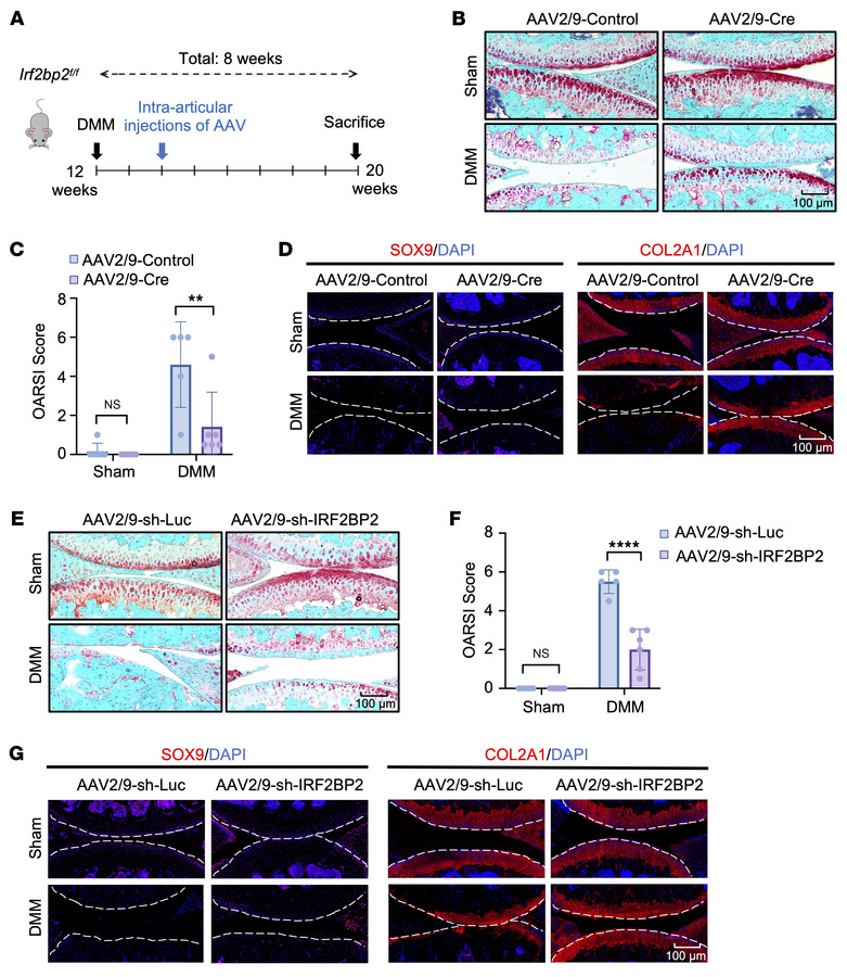IRF2BP2 represents a promising therapeutic target for OA treatment.
(A) ...