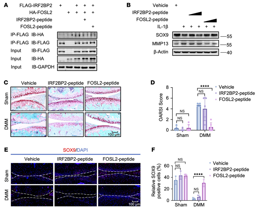 Therapeutic peptides targeting the IRF2BP2-FOSL2 interface attenuate OA ...
