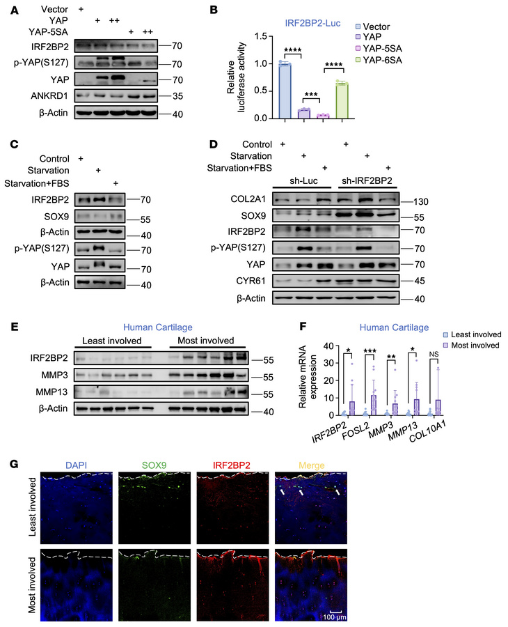 IRF2BP2 acts as a Hippo pathway hub component to modulate SOX9 expressio...