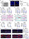 Cartilage-specific deletion of Irf2bp2 attenuates OA progression and associ