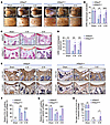Cartilage-specific loss of Irf2bp2 inhibits fibrocartilage formation, facil