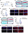 IRF2BP2 represents a promising therapeutic target for OA treatment.