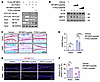 Therapeutic peptides targeting the IRF2BP2-FOSL2 interface attenuate OA pro