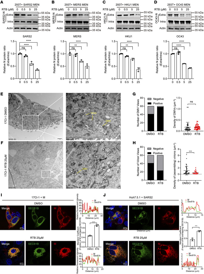 RTB inhibits virion assembly by trapping the M protein in the ER.
(A–D) ...
