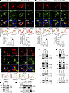 HGS interacts with M protein and facilitates its trafficking to ERGIC.
