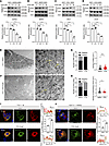 RTB inhibits virion assembly by trapping the M protein in the ER.
