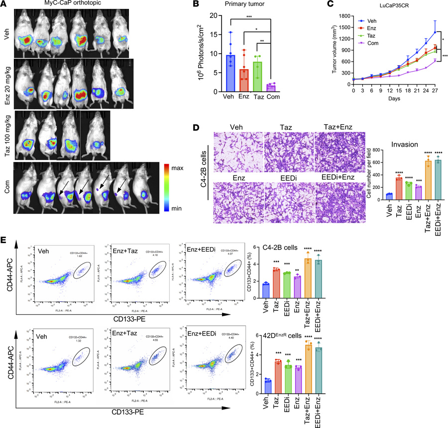 Therapeutic targeting of PRC2/EZH2 and the AR increases drug resistance ...