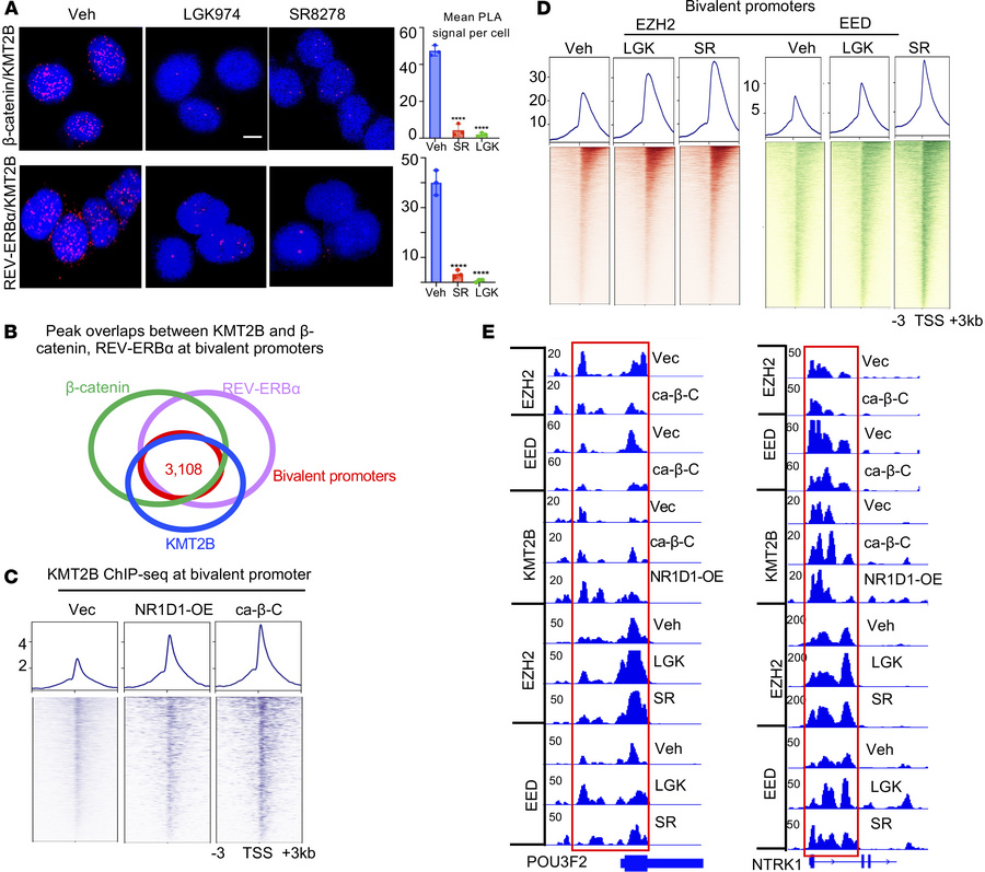 Hyperactive Wnt/β-catenin and REV-ERBα promote KMT2B function and antago...