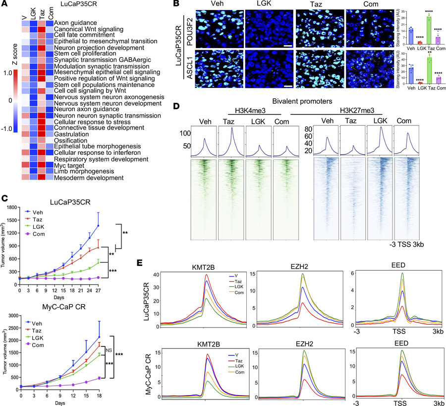 Induction of tumor cell–state diversity by PRC2/EZH2 inhibition can be m...
