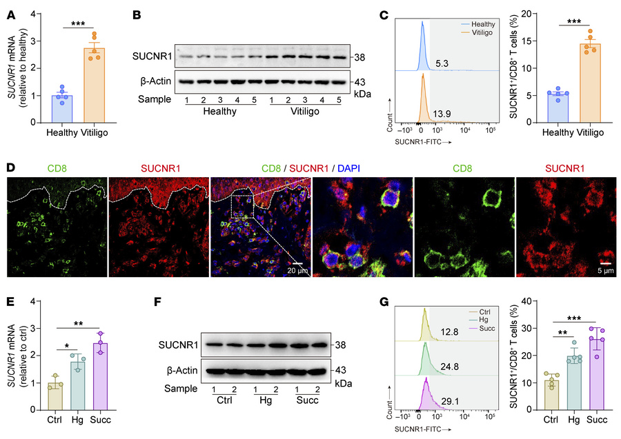 Upregulated SUCNR1 expression in vitiligo CD8+ T cells is modulated by h...