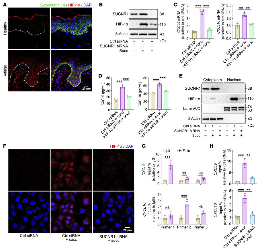 Succinate promotes HIF-1α nuclear translocation and its binding to CXCL9...