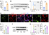 Upregulated SUCNR1 expression in vitiligo CD8+ T cells is modulated by hype