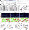 Succinate aggravates vitiligo through SUCNR1.