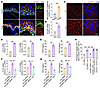 Succinate-induced chemokine secretion via SUCNR1 in keratinocytes promotes