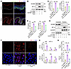 Succinate promotes HIF-1α nuclear translocation and its binding to CXCL9/CX