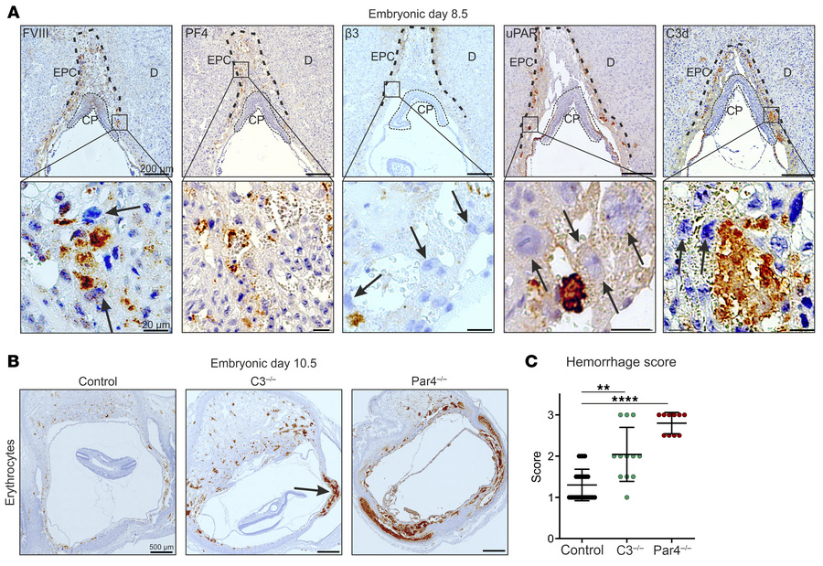Coagulation and complement regulate maternal blood flow at the developin...