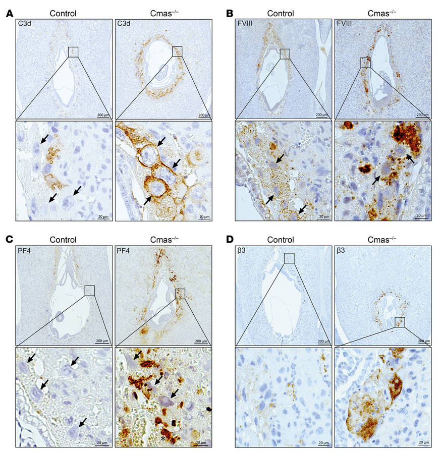 Loss of placental complement regulation results in excessive thrombosis....