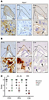 PAR4-mediated platelet activation is crucial for thrombus formation at the
