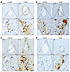 Loss of placental complement regulation results in excessive thrombosis.