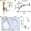 Complement activation results in decreased TM levels.