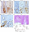 PAR4-mediated platelet activation drives C3 deposition on trophoblasts, but