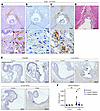 Platelet depletion mitigates excessive thrombosis and developmental deficit