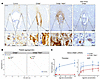 Par4–/– platelets at the fetal-maternal interface can be activated via thro