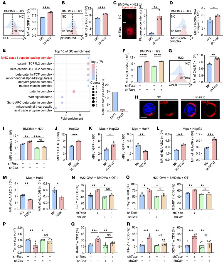 TESC restrains CALR membrane translocation to inhibit macrophage functio...