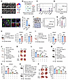 Tumor-intrinsic TESC contributes to resistance to antitumor immunity and im