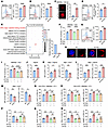 TESC restrains CALR membrane translocation to inhibit macrophage function.