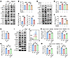 TESC regulates CALR surface exposure by modulating calcium homeostasis and