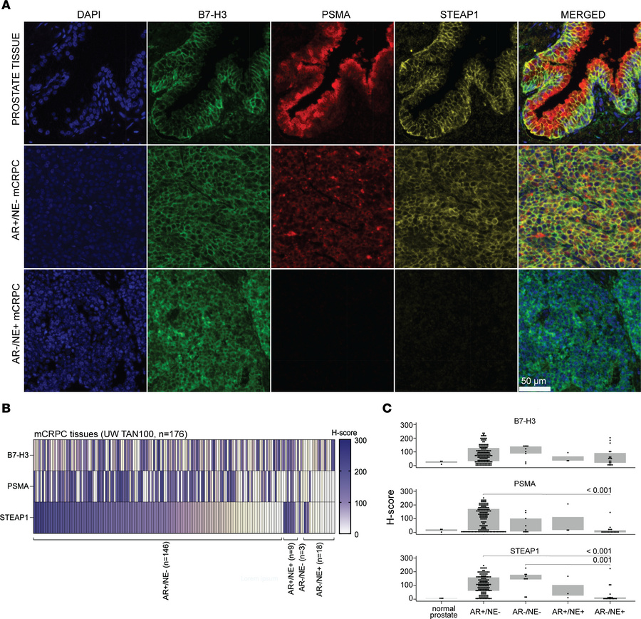B7-H3, PSMA, and STEAP1 are expressed in the majority of AR-regulated mC...