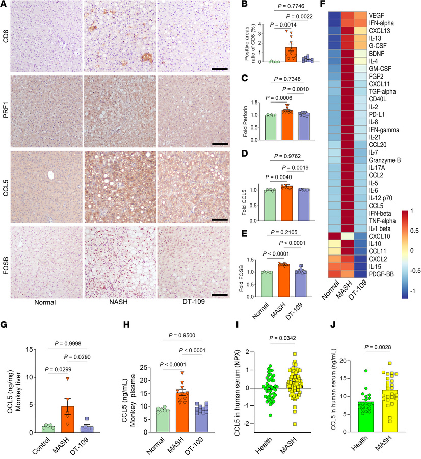 DT-109 effectively restores liver immune homeostasis in monkeys with MAS...