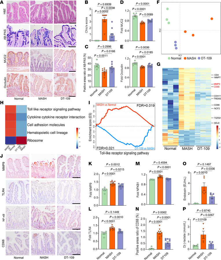 DT-109 alleviates intestinal barrier damage in monkeys with MASH.
(A) He...