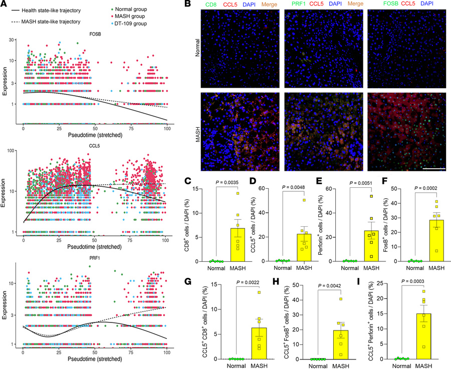 Elevated expression of FOSB, CCL5, and PRF1 in CD8+ T cells in MASH live...