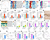 Elevated ammonia-producing gut bacteria in monkeys with MASH.