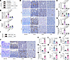 Ammonia produced by C. perfringens induces gut barrier disruption and hepat