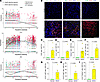 Elevated expression of FOSB, CCL5, and PRF1 in CD8+ T cells in MASH livers.