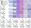 C. perfringens–directed therapeutics suppress MASH progression in mice.