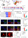 CED-dexamethasone suppresses inflammatory myeloid programs in glioma, reduc