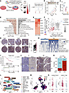 In vivo CRISPR screens identify CBX4 as an immune evasion target.